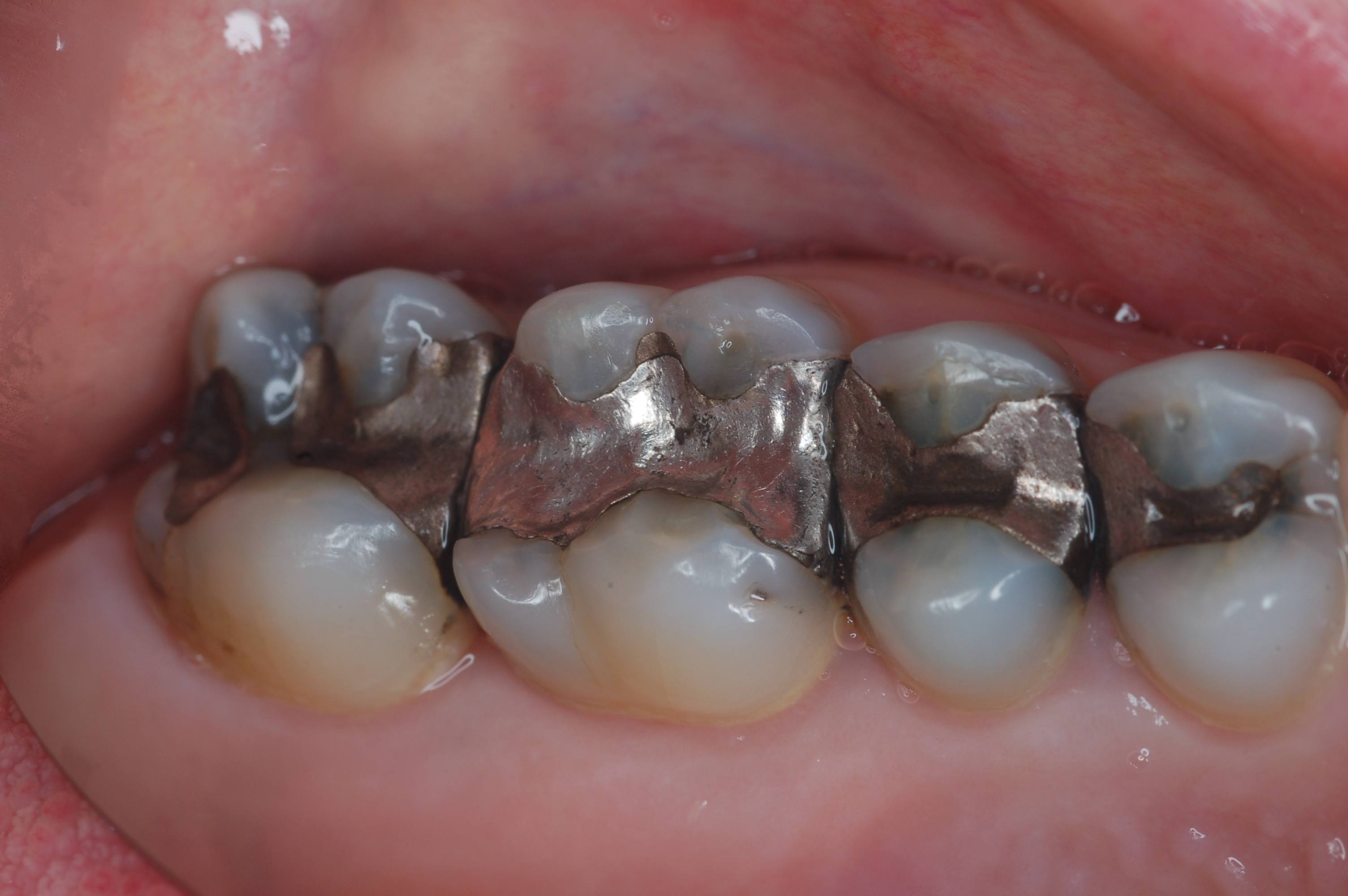 What is Holistic Dentistry and What Makes It Different? Integrative